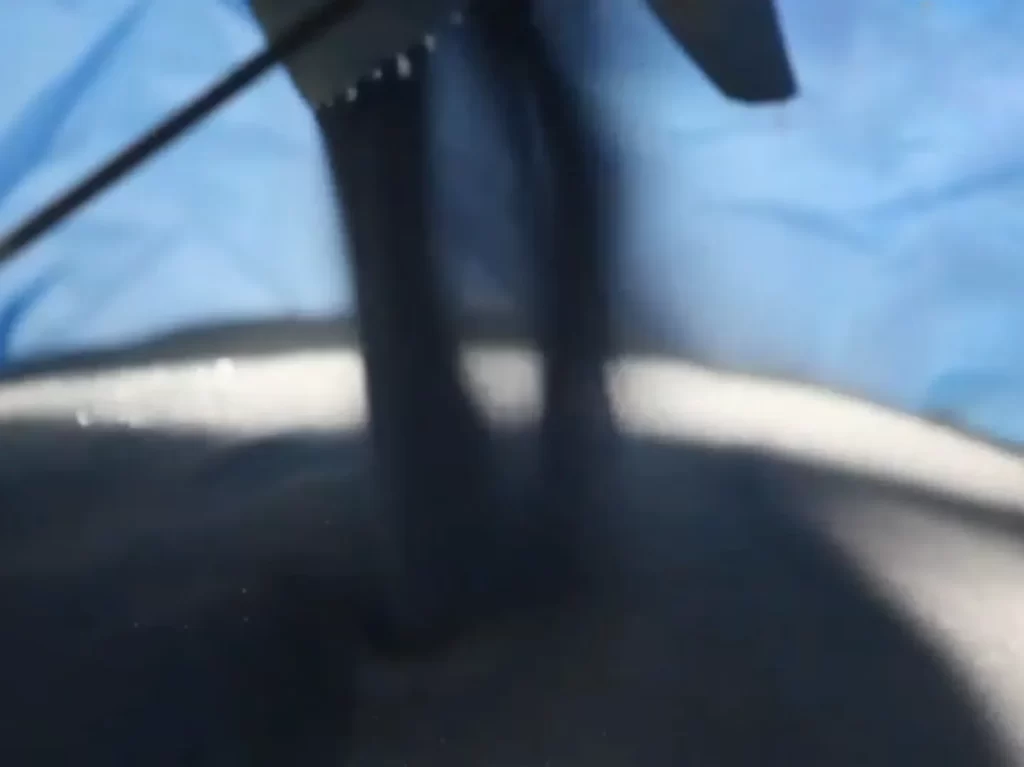 ข้อดี  -4-